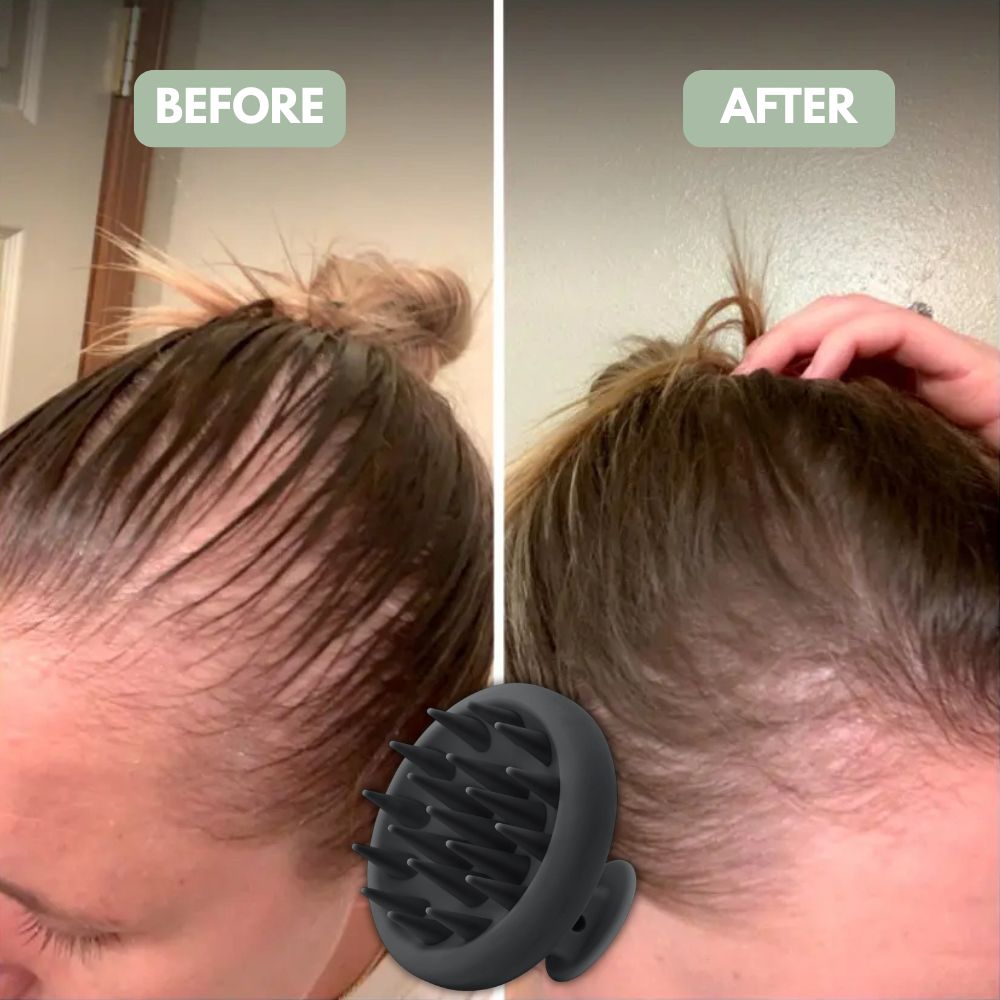 Premium Women Scalp Massager