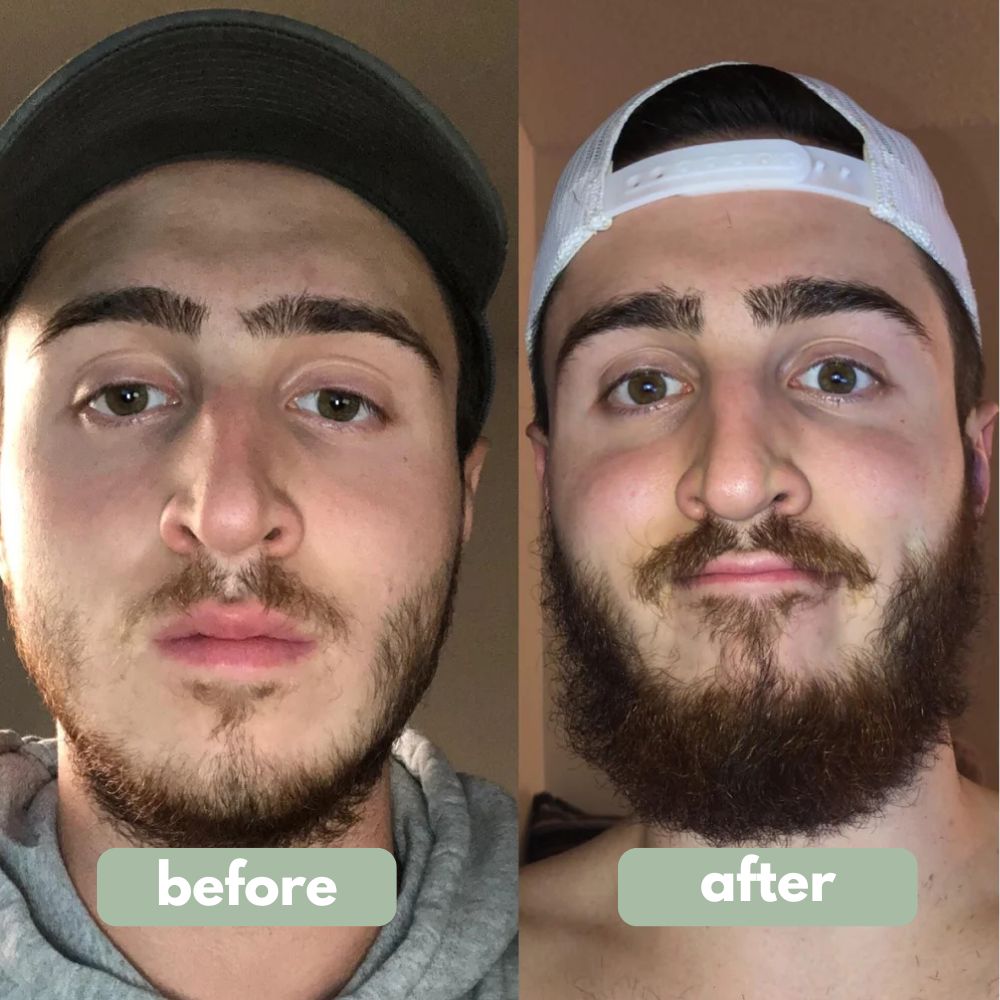Reverse - Beard Growth Serum