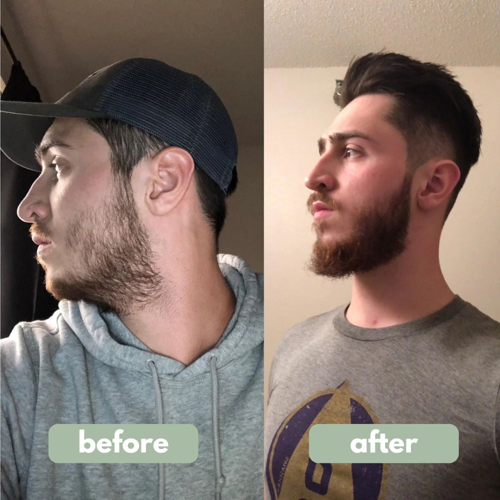 Reverse - Beard Growth Serum