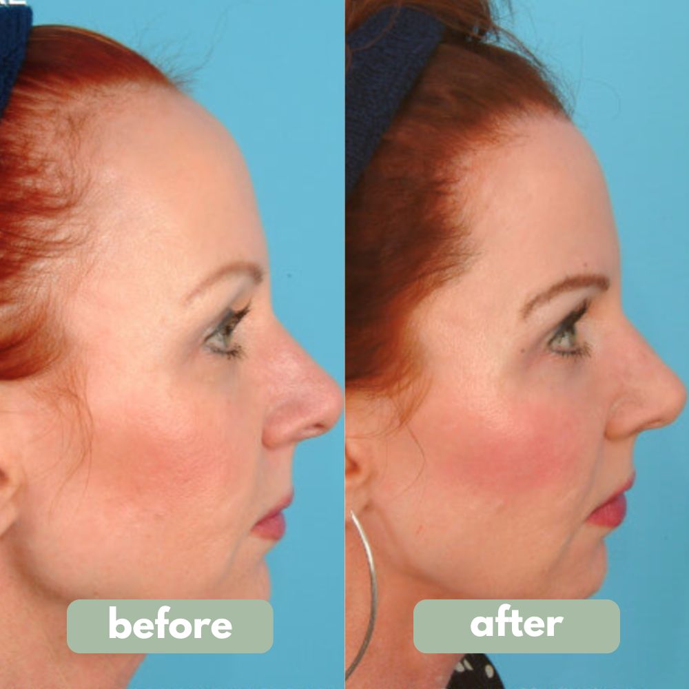 Reverse - Hair Growth Serum