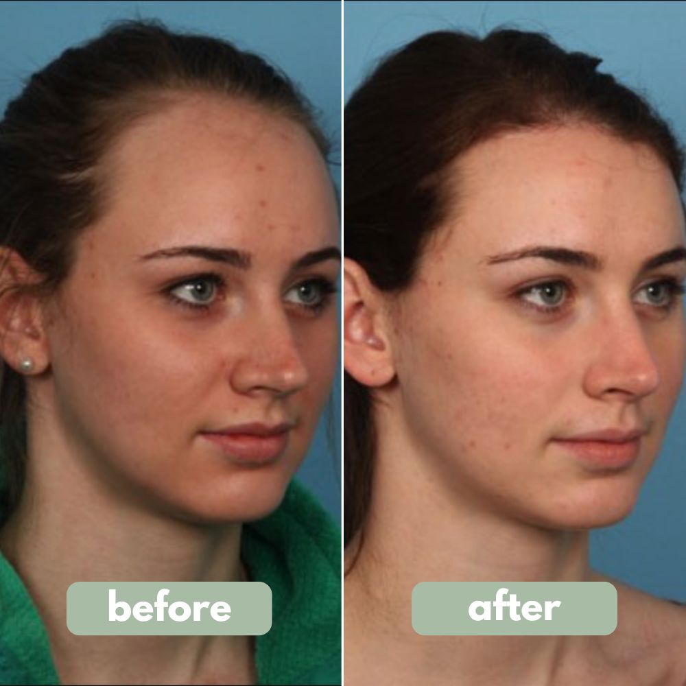 Reverse - Hair Growth Serum